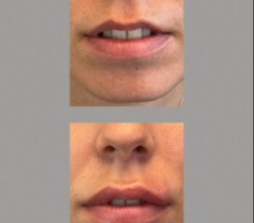 Russian Lips Made in Genève