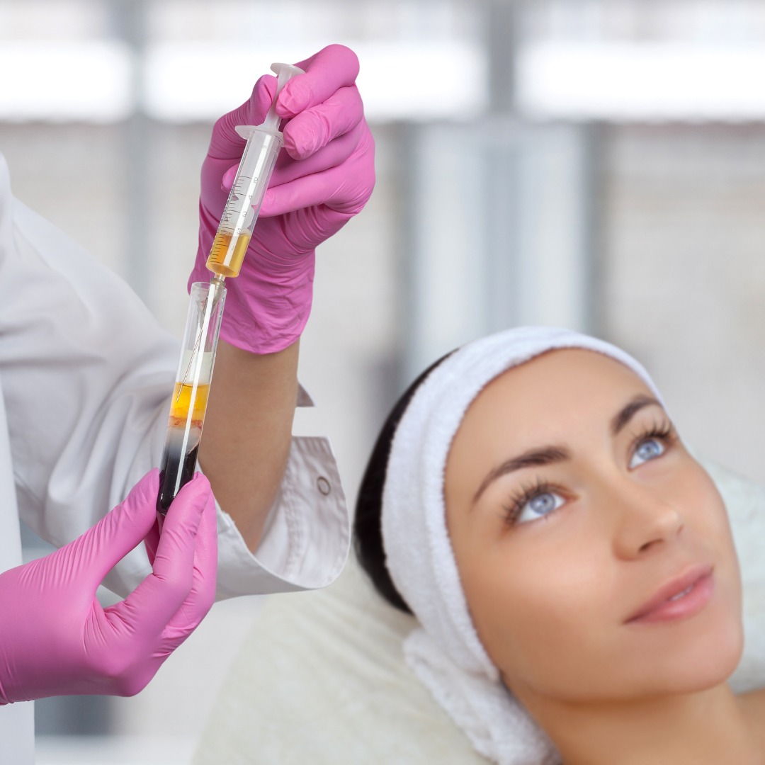 Injection PRP pour le visage
